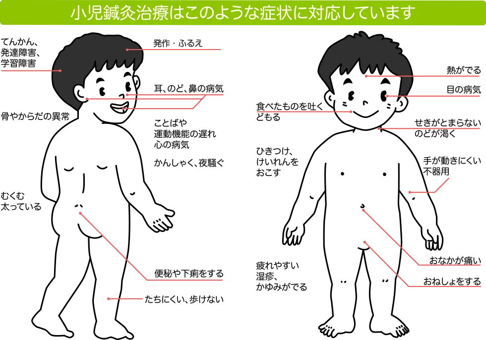 小児鍼灸治療はこのような症状に対応しています