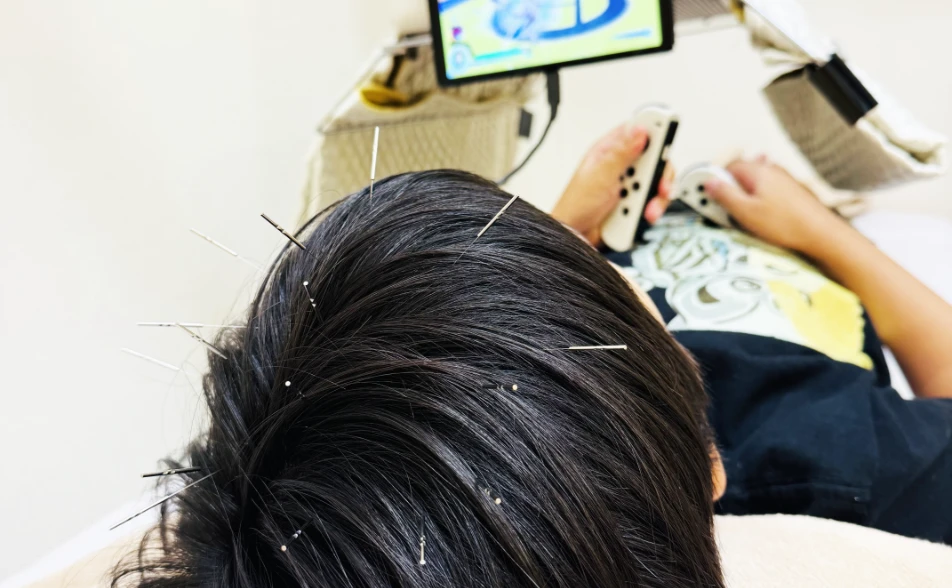 てんかん