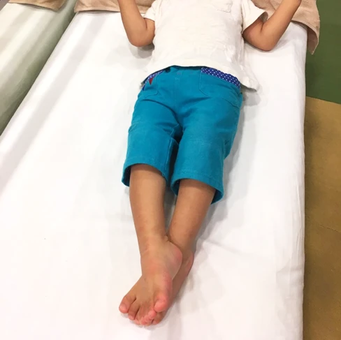 脳室周囲白質軟化症(PVL)の初期症状（下肢）