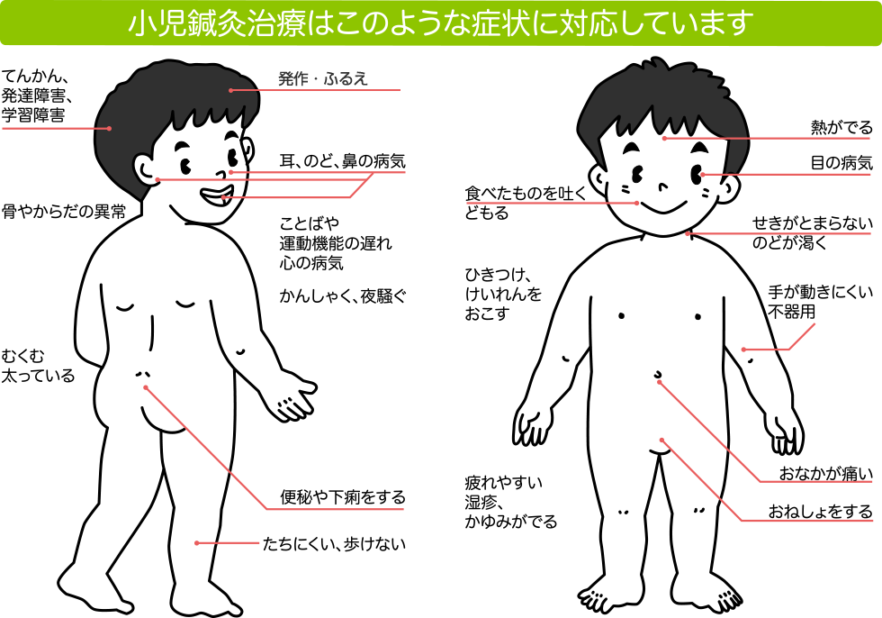 小児鍼灸治療はこのような症状に対応しています