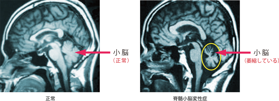 検査方法の画像