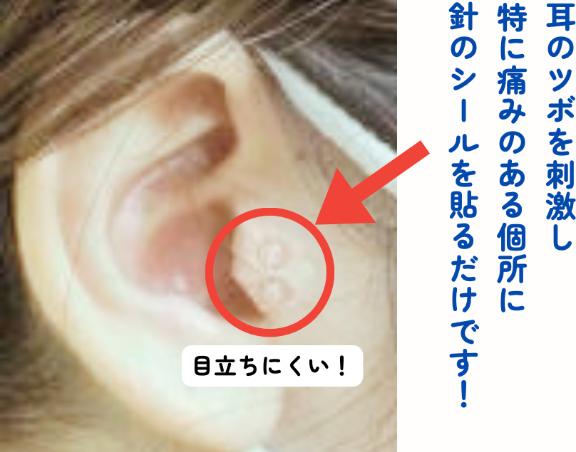 耳ツボの画像